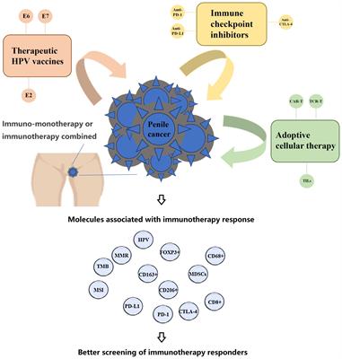 Advances in molecular basis of response to immunotherapy for penile cancer: better screening of responders